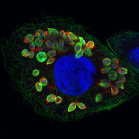 Leishmania-infected macrophage