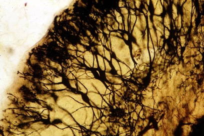 Neuroscience