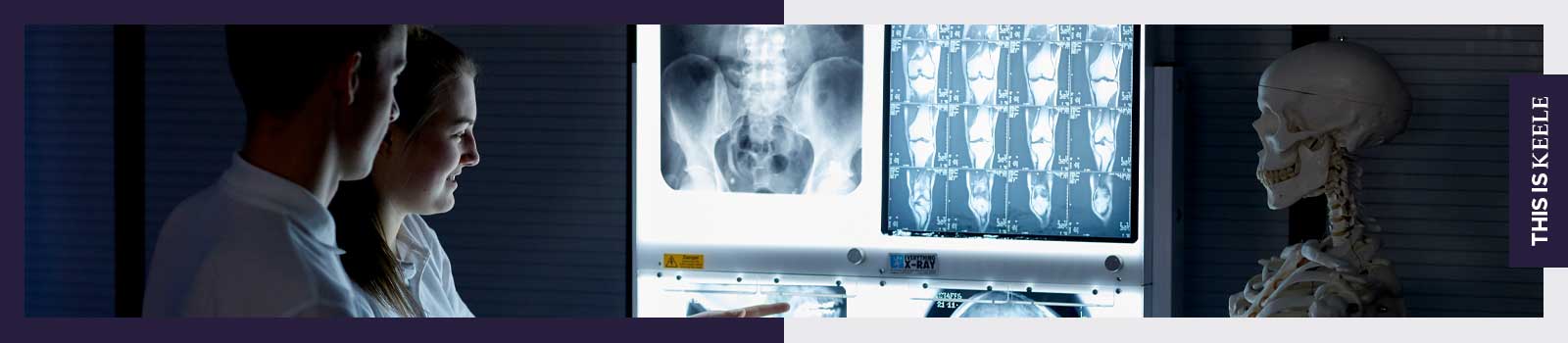 Physiotherapy students looking at an x-ray at Keele University